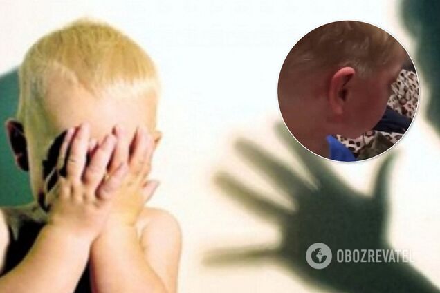 В Омську (Росія) мати і вітчим жорстоко катували дитину