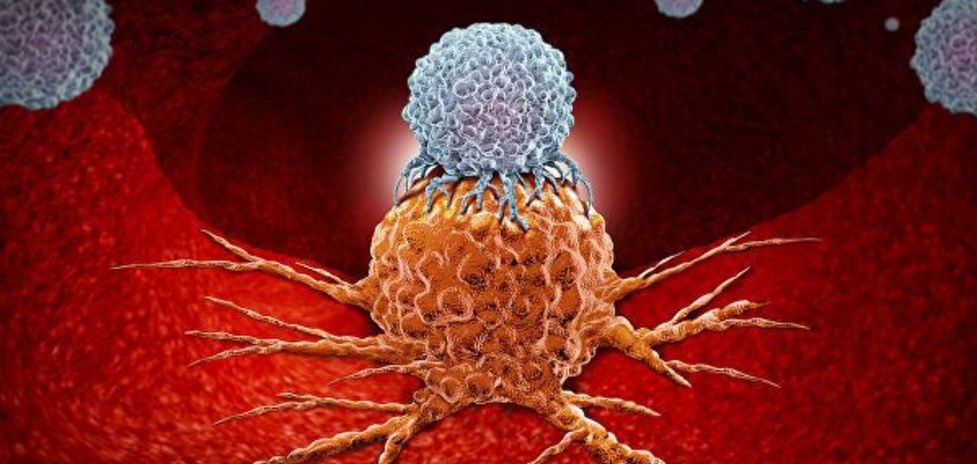 Эксперты возлагают большие надежды на иммунотерапию рака