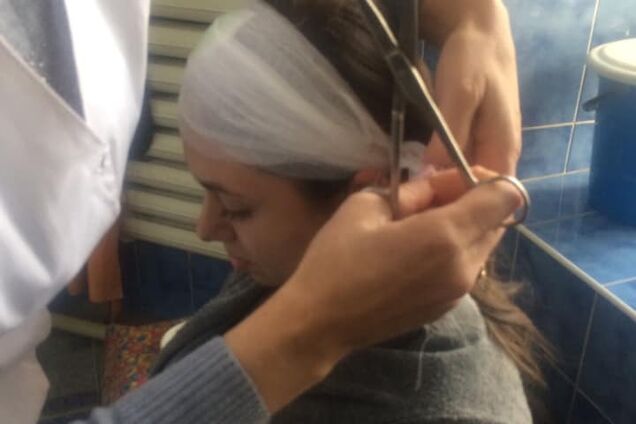 В Одессе на голову женщины рухнул кусок дома