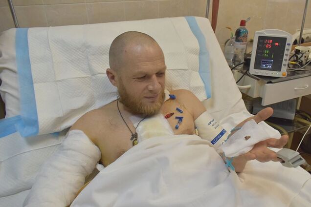 Попросил пулю на память: в Днепре чудом спасли воина ВСУ со снайперским ранением