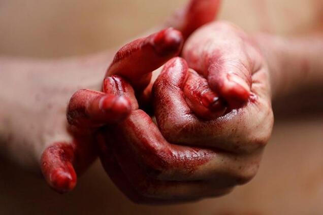 Встромив ножа в груди заради лайків: у Дніпрі по-звірячому познущалися над чоловіком на камеру