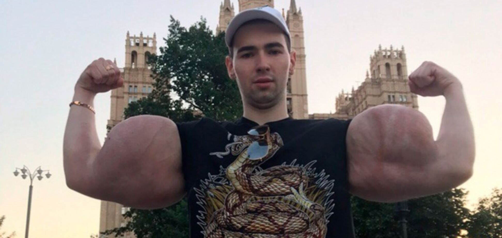 Руки-базуки после операции подрался с бывшим зеком