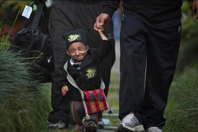 Умер самый маленький человек в мире: как он выглядел