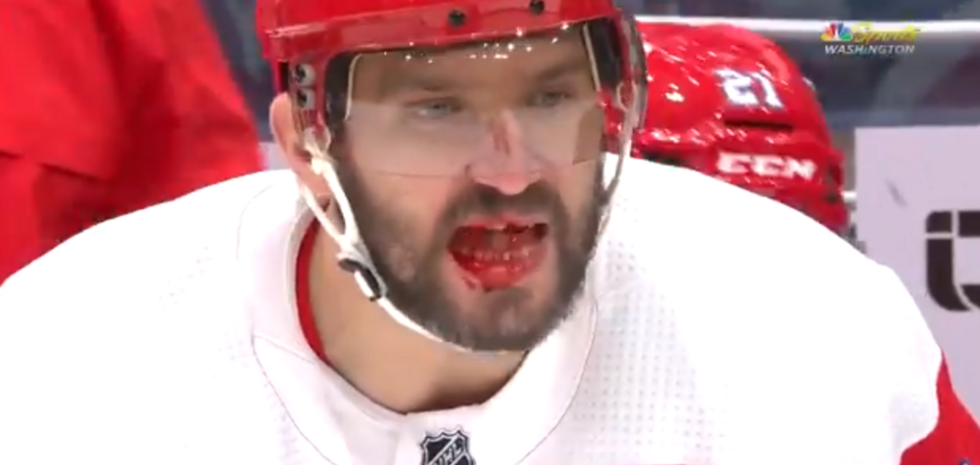 Овечкину устроили кровавую стычку