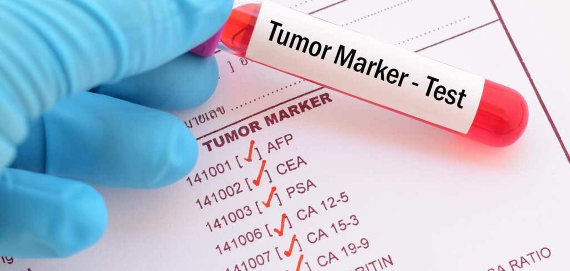 онкомаркери для контролю рецидиву раку