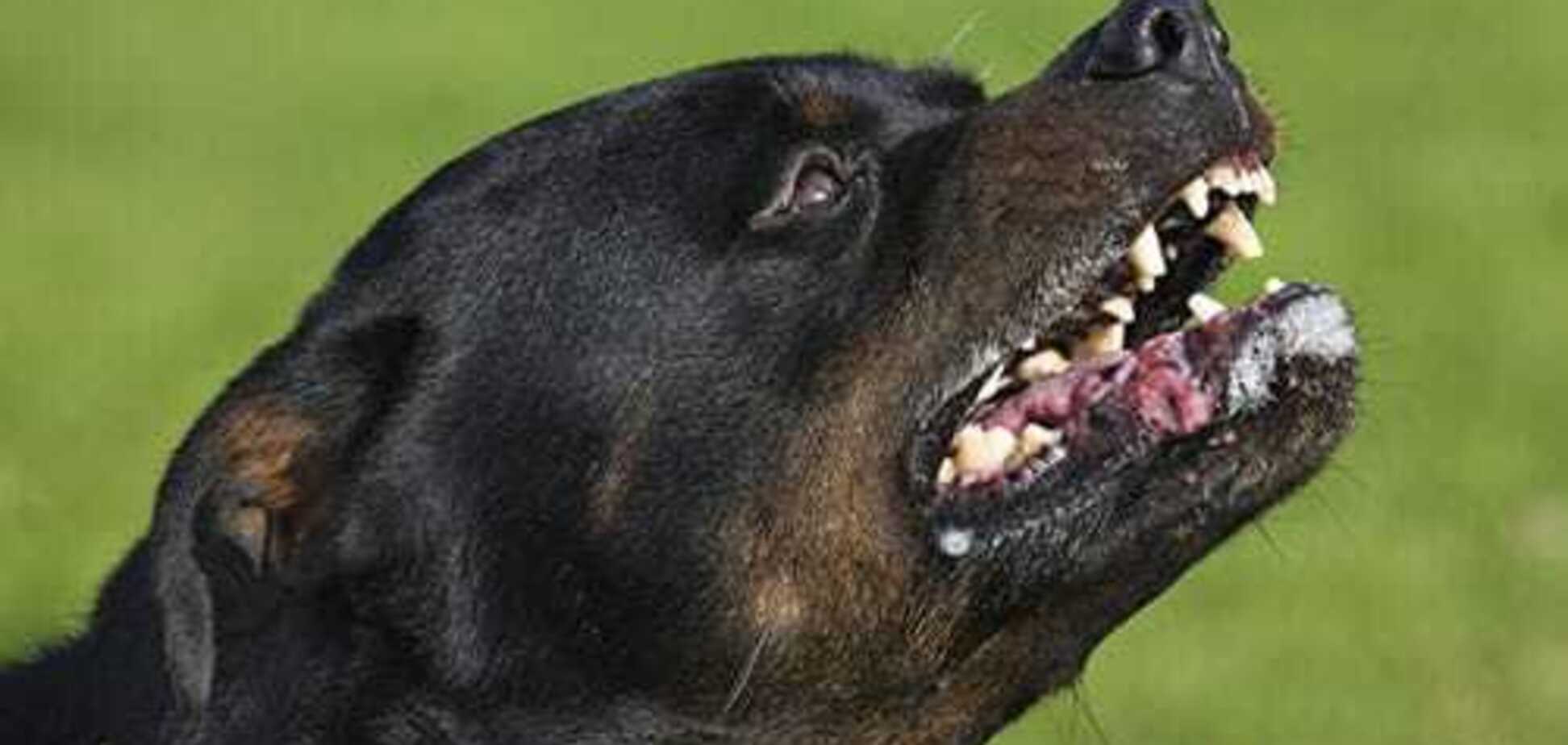 Врачи сообщили о состоянии жертвы ротвейлера в Одессе