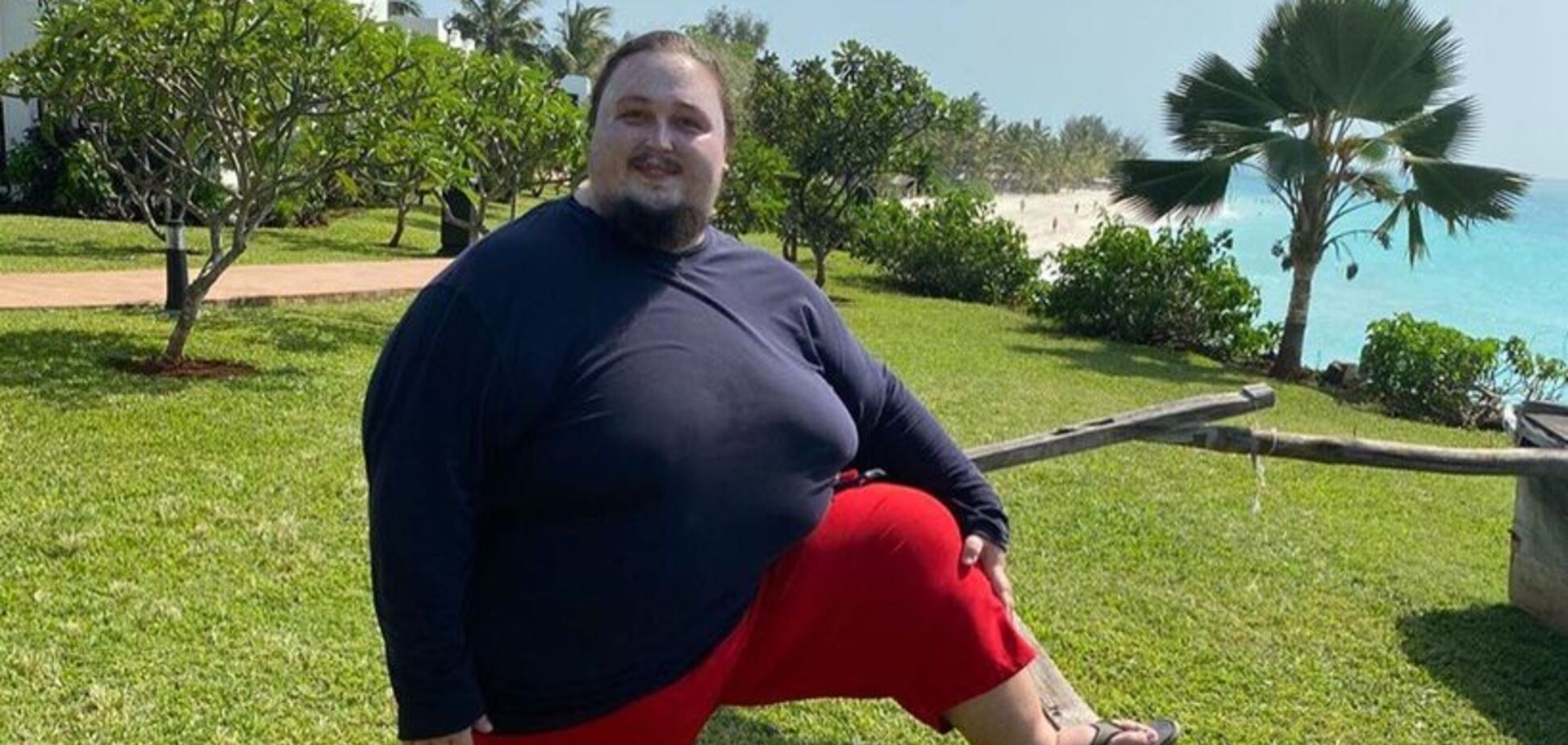 'Кожа слезает': 240-килограммовый сын известного российского художника получил сильные ожоги