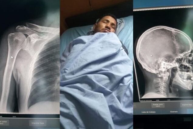 Экс-чемпион мира по боксу найден избитым до полусмерти