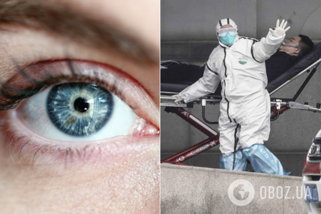 Берегите глаза! Ученые предупредили о новой опасности коронавируса