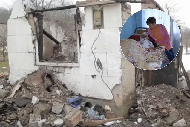 Отец-садист поджег родную дочь: как 16-летняя украинка борется за жизнь