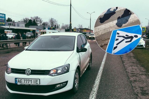 Під Дніпром автомобіль збив маму з дитиною на 'зебрі': фото з місця ДТП