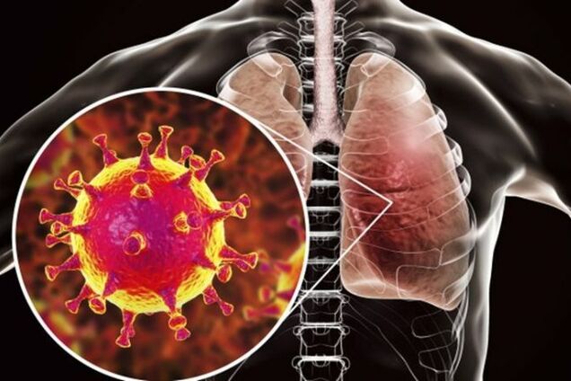 Что будет, если коронавирус достигнет Украины