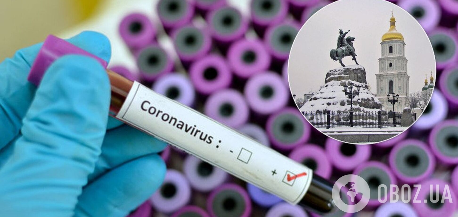 Эксперты объяснили, какой коронавирус обнаружили в Киеве