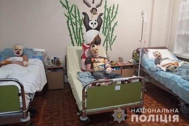 На Тернопільщині шахраї вкрали гроші на лікування обгорілих дітей