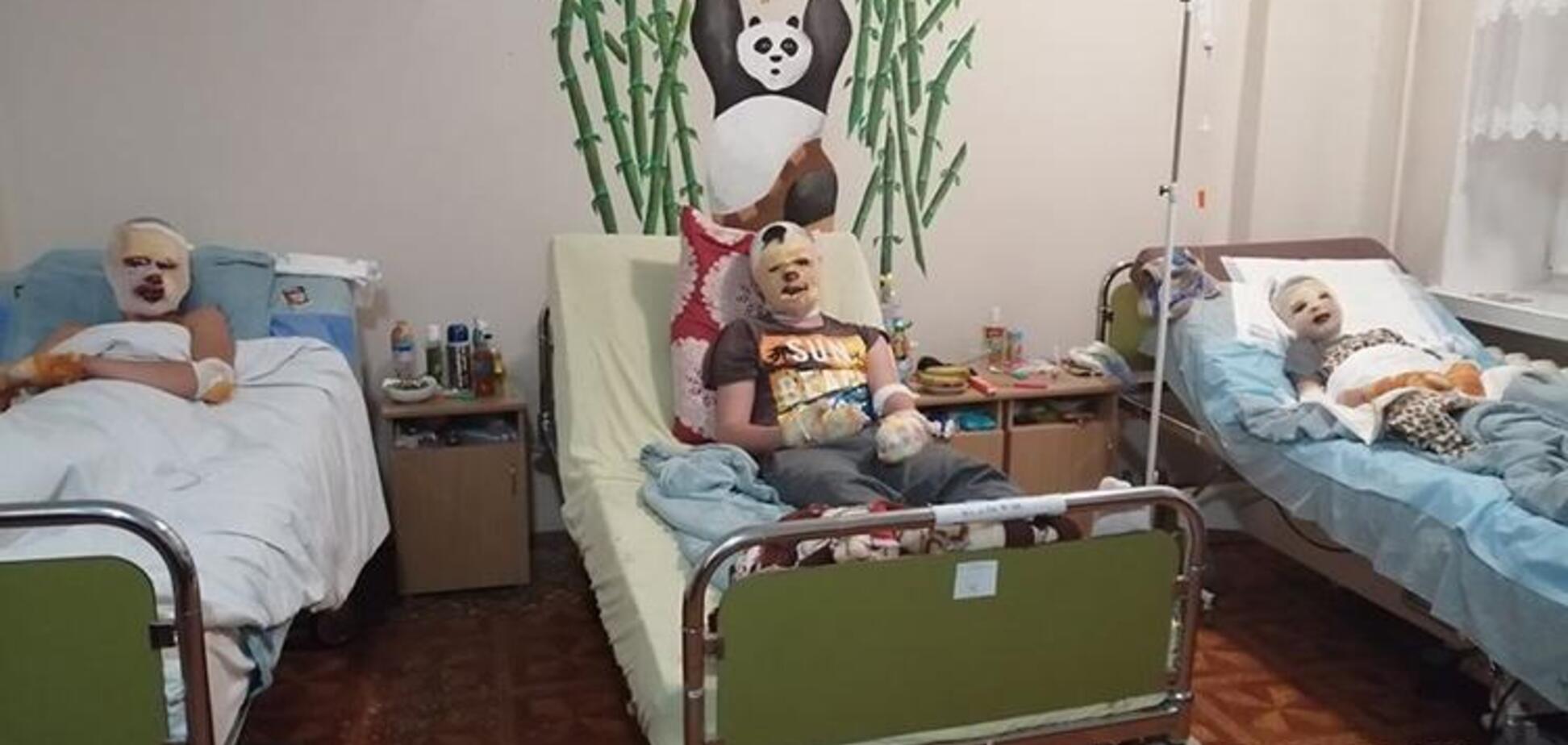 На Тернопольщине мошенники украли деньги на лечение обгоревших детей