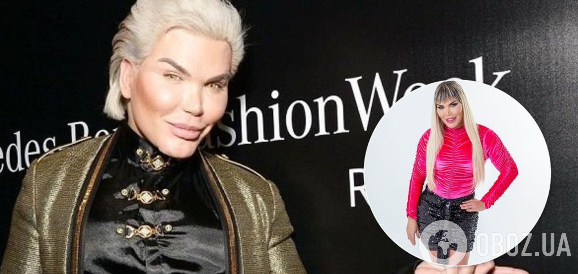 'Я завжди відчував себе Барбі': живий Кен почав перетворюватися на жінку