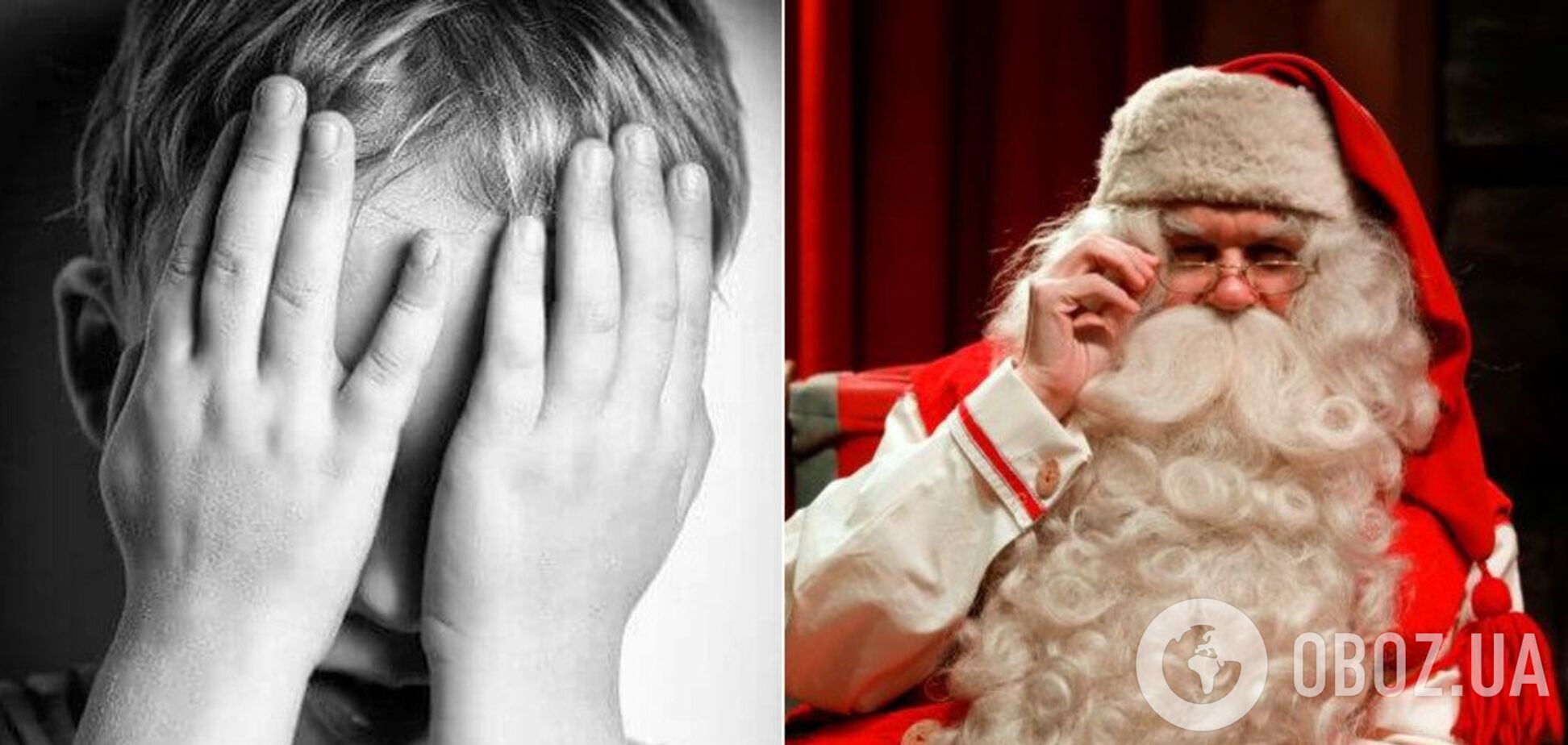 В Крыму Дед Мороз в новогоднюю ночь сжег ребенку лицо. Иллюстрация