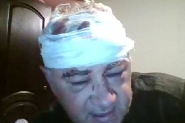 Под Одессой устроили кровавую расправу над ветераном АТО