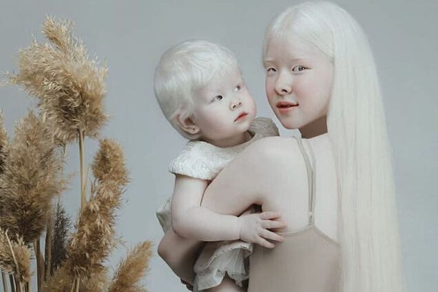 Сестри-альбіноси з Казахстану підкорили світ незвичайною красою. Фото