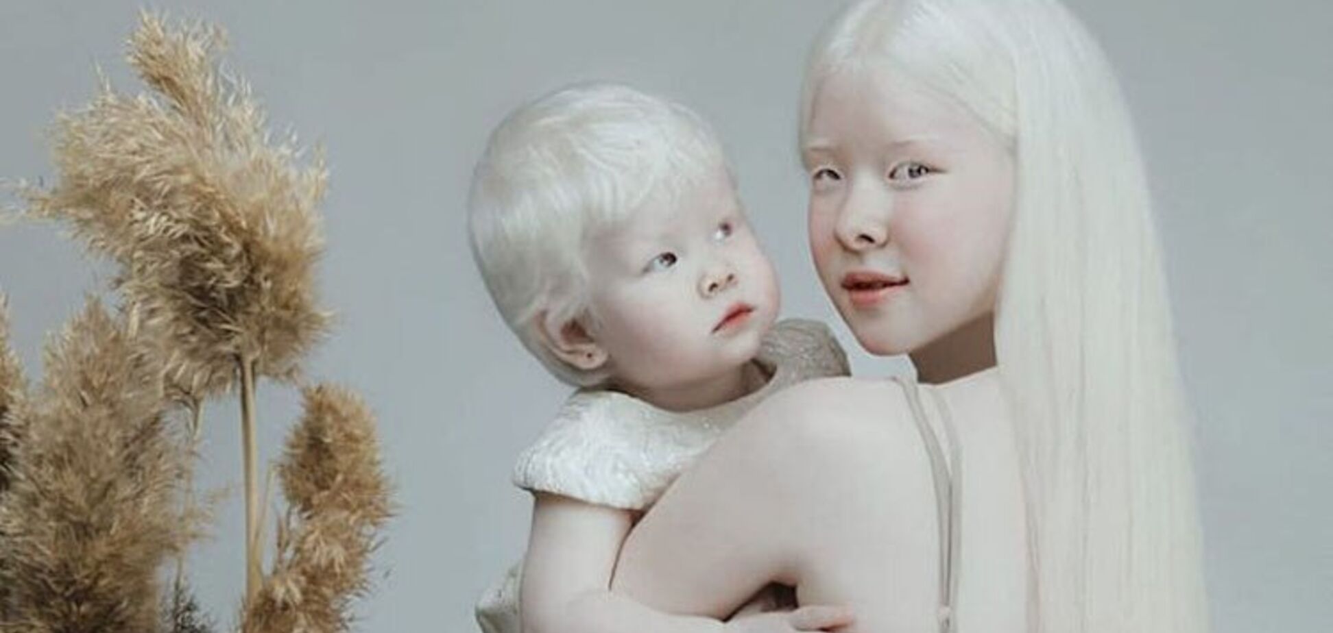 Сестри-альбіноси з Казахстану підкорили світ незвичайною красою. Фото