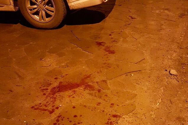 Лежав у калюжі крові: у центрі Дніпра під час сварки вбили хлопця. Фото 18+