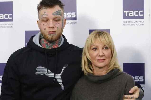 Сын запрещенной в Украине Яковлевой показал обезображенное лицо: фото