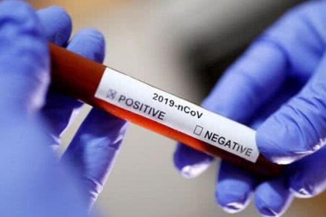 Вистачить на 30 випадків: Україна отримала тест-системи для діагностики смертельного коронавірусу