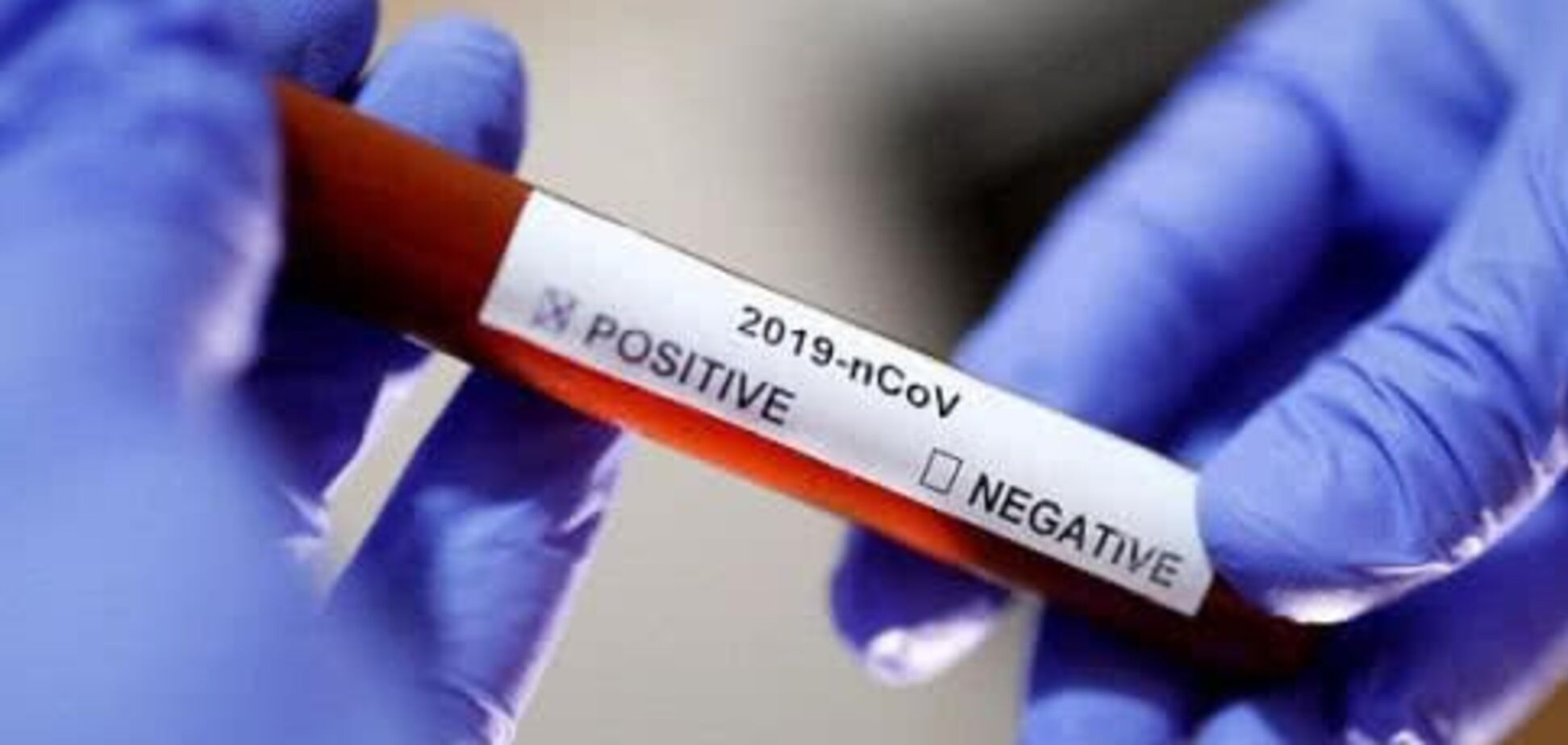 В Україні ще два випадки зараження коронавірусом: у Житомирській та Чернівецькій областях