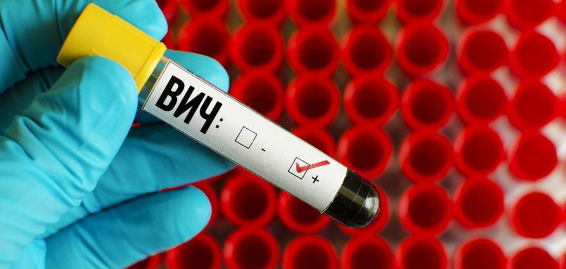 Вакцини не буде: щеплення від ВІЛ не пройшло випробування