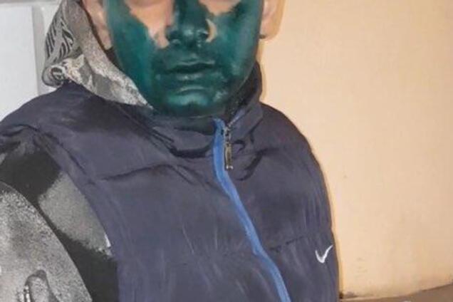 Дали зеленку: в Днепре таксисты жестко поиздевались над пассажиром