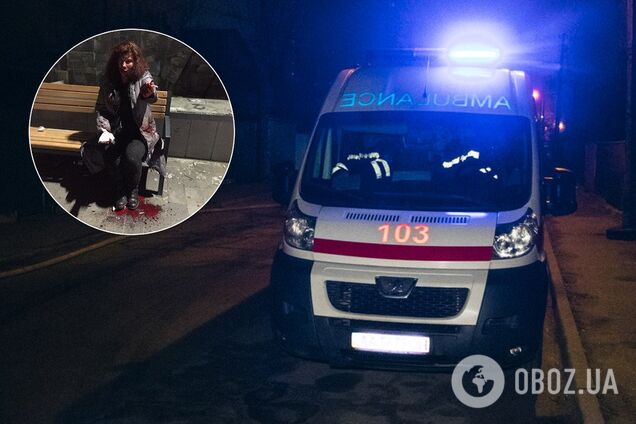 Сломан нос и выбиты зубы: в Киеве женщина пожаловалась на избиение из-за русского языка