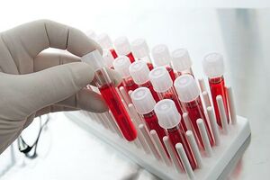 Подтверждающий тест на поверхностный антиген вируса гепатита В (HВsAg confirmatory)
