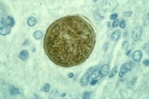 Посев на E.coli О157:Н7 с определением чувствительности к антибиотикам