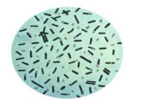 Посев на Clostridium difficile