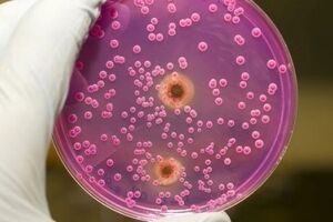 Посев на дрожжевые грибы с определением чувствительности к антимикотическим препаратам