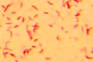 Микроскопия нативного мазка, окраска по Граму