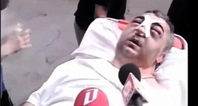 Сломали челюсть по воле Саакашвили: стало известно о жутком инциденте в Грузии