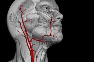 Стеноз сонной артерии: причини виникнення та основні симптоми, способи лікування захворювання