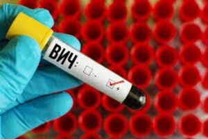 ВИЧ инфекция: причины возникновения и основные симптомы, способы лечения заболевания