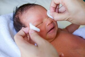 Дакриоцистит новорожденного: причини виникнення та основні симптоми, способи лікування захворювання