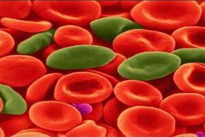 Мегалобластная анемия: причини виникнення та основні симптоми, способи лікування захворювання