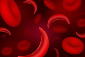 Железодефицитная анемия: причины возникновения и основные симптомы, способы лечения заболевания
