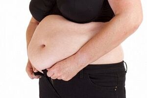 Абдоминальное ожирение: причини виникнення та основні симптоми, способи лікування захворювання