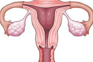 Аномалии женских половых органов: причини виникнення та основні симптоми, способи лікування захворювання