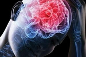 Тревожное расстройство: причини виникнення та основні симптоми, способи лікування захворювання