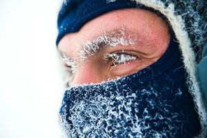 Обморожение: причины возникновения и основные симптомы, способы лечения заболевания