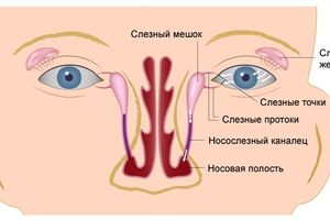 Дакриоцистит: причины возникновения и основные симптомы, способы лечения заболевания