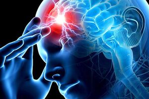 Генерализованная эпилепсия: причини виникнення та основні симптоми, способи лікування захворювання