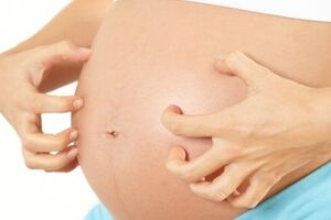 Сверблячка при вагітності: причини виникнення та основні симптоми, способи лікування захворювання