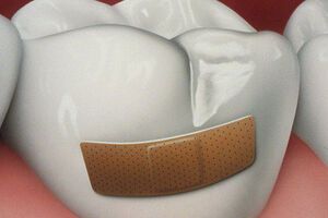 Заболевания твердых тканей зуба: причины возникновения и основные симптомы, способы лечения заболевания
